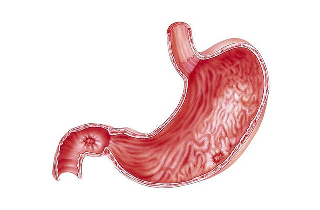 胃部清洁剂被发现开水煮一煮轻松撵走幽门螺杆菌