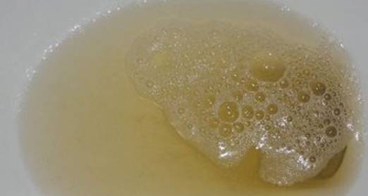 女人早上上厕所时,若有这些表现,说明你的子宫很健康_尿液