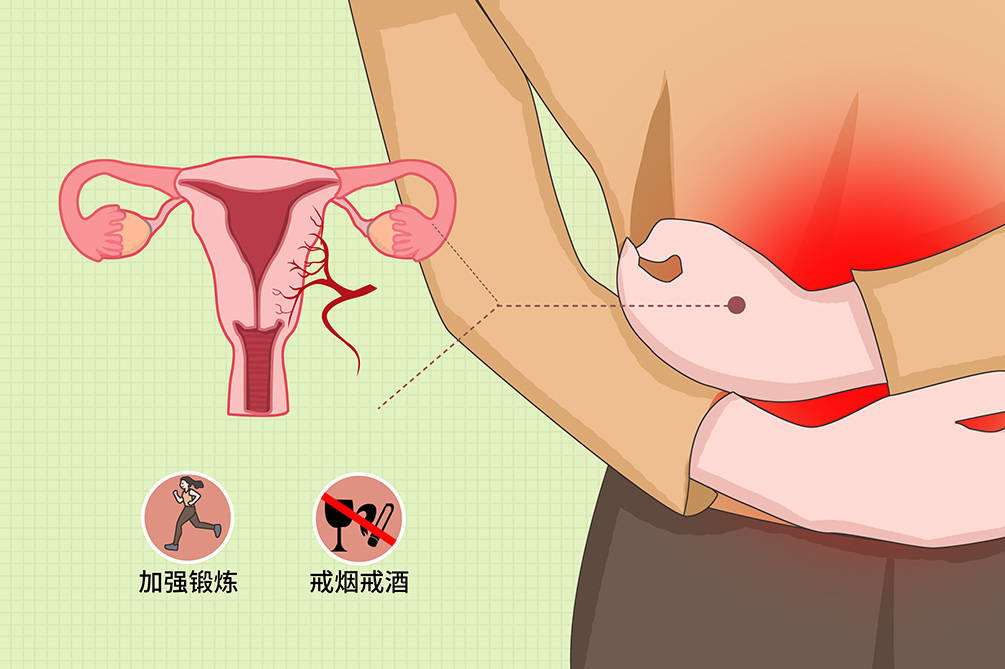 子宫内膜异位有癌变的风险吗
