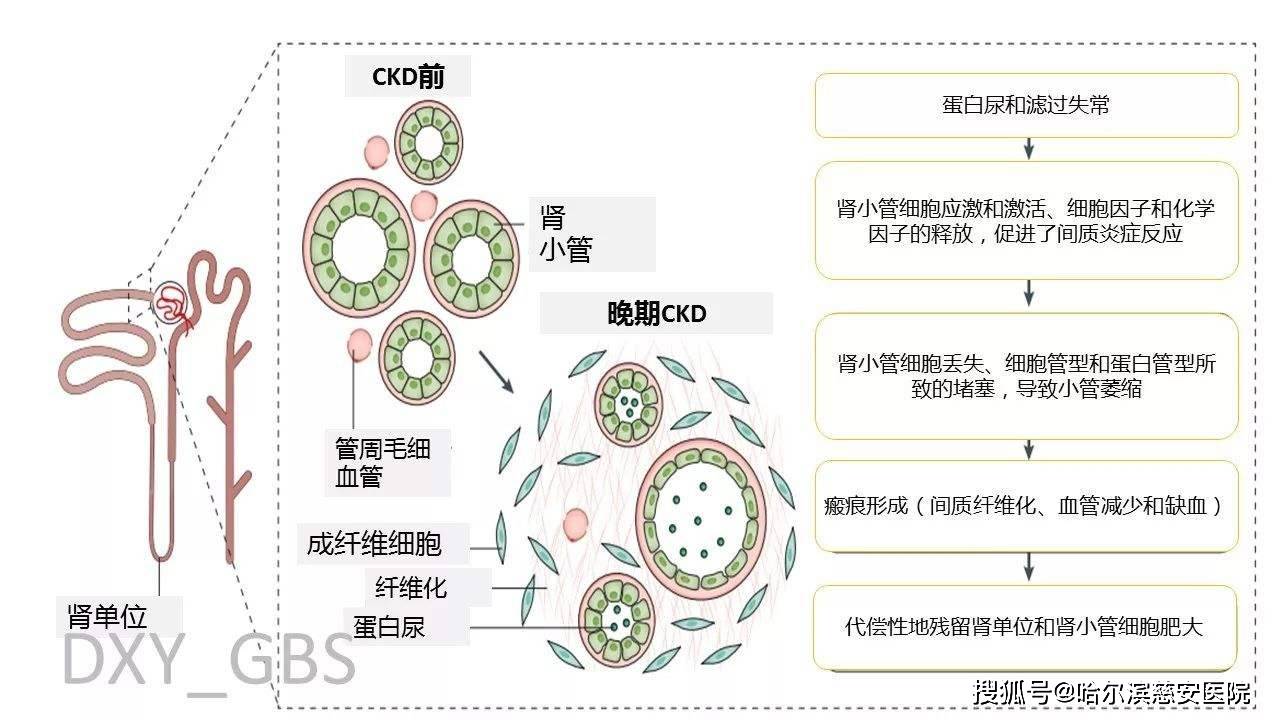 24小时尿hco4-仅可滴定酸正常,尿钙可增高或正常(测尿pco2时可注入n2.