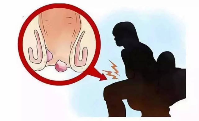 病灶不断加重,形成脱肛,直肠粘膜脱出,使肛门括约肌松弛,致肛门失禁