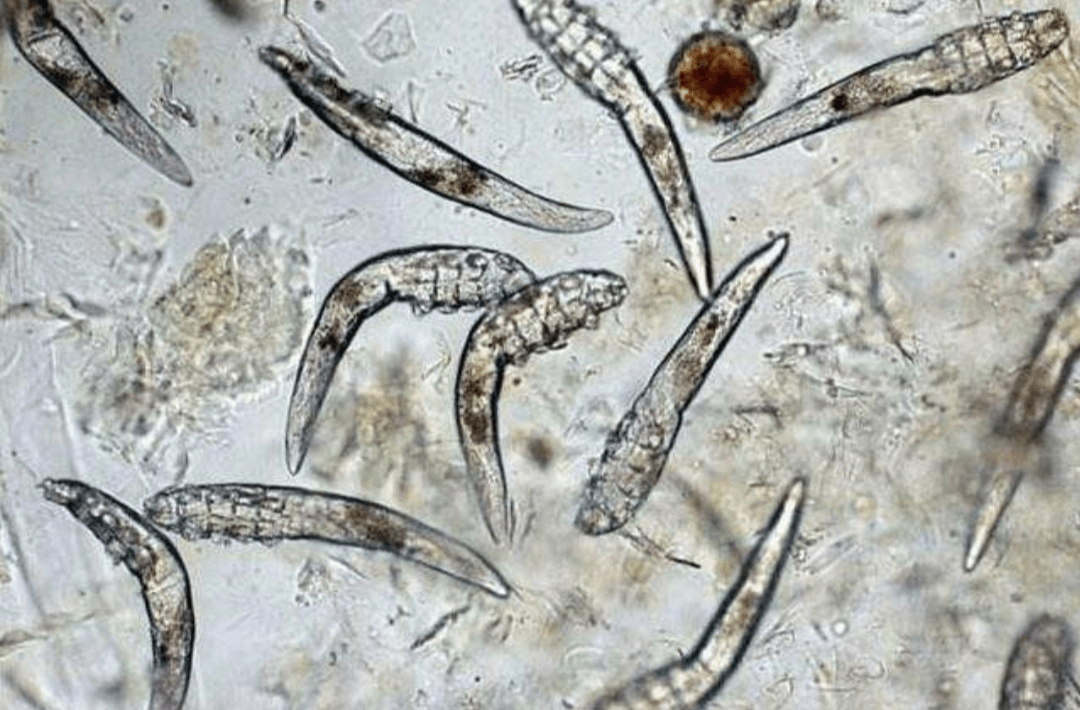 犬皮肤细菌感染显微镜图片