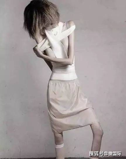 她是世上最瘦的女孩,体重仅44斤像纸片人,你还喜欢瘦女孩吗?