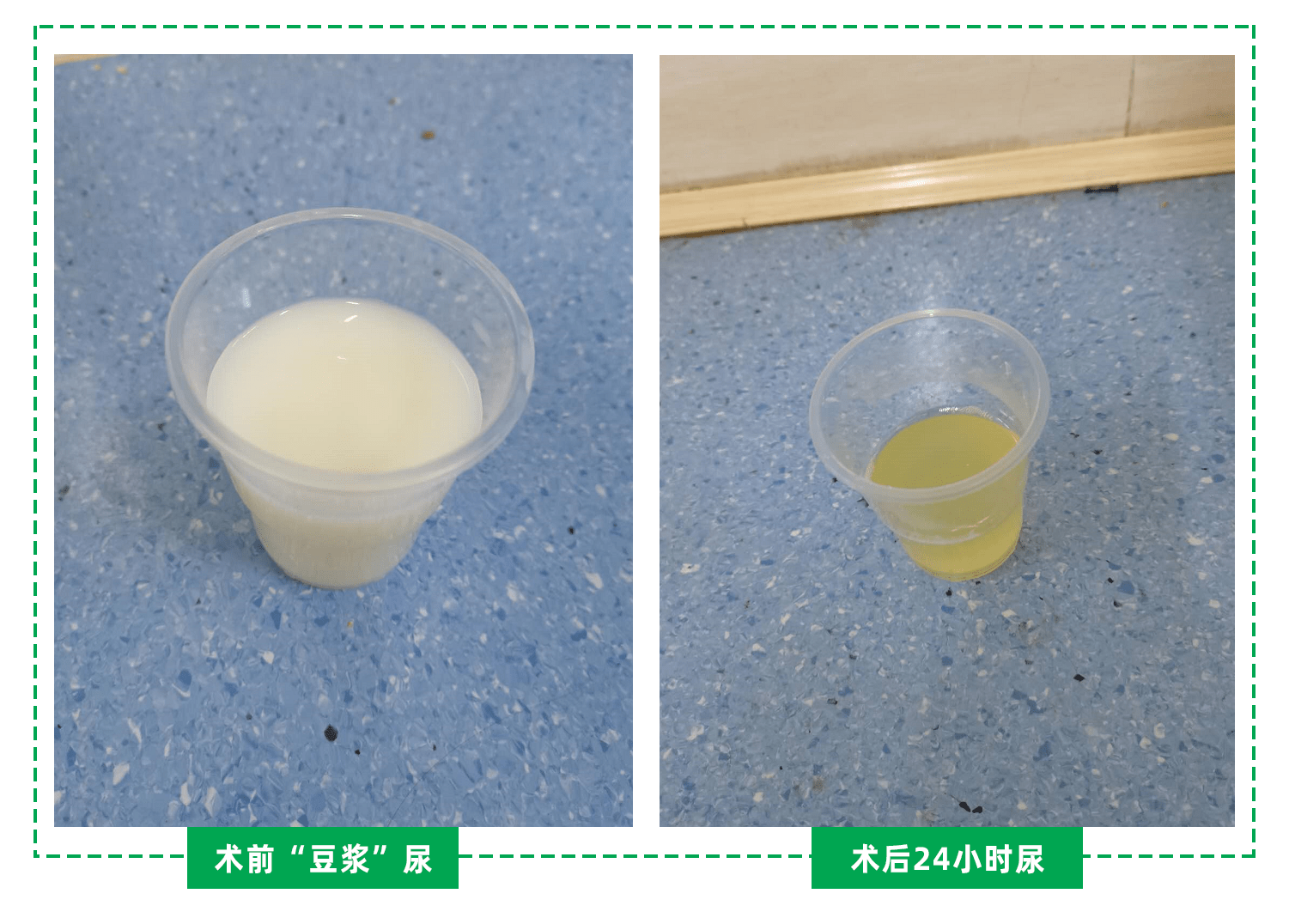 尿液是人健康的"晴雨表"可以从中看出身体是否健康_手机搜狐网