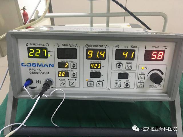 (射频治疗仪)自19世纪开始已有使用电流损伤神经系统的动物实验,到20