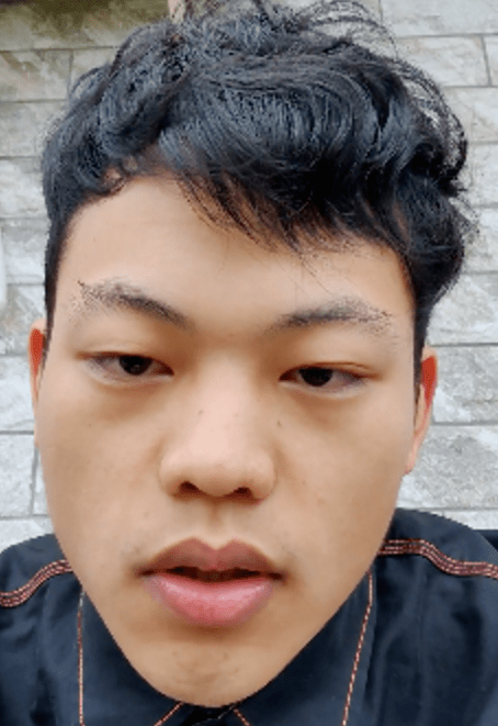 被癌症砸中,"面筋哥"如坠冰窖,如日中天的事业该如何安放?