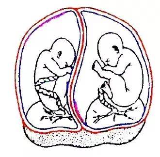 双绒双羊:两个宝宝各自有独立的胎盘,类似于住在联排双拼别墅