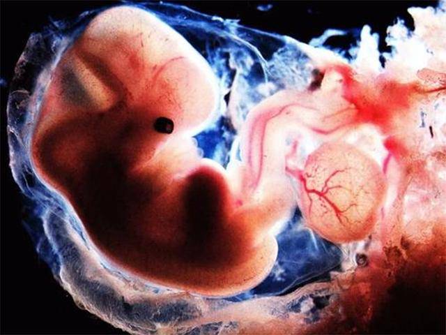 怀孕56天胎儿图片图片