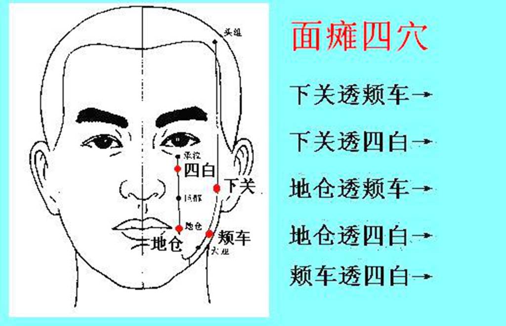 目三针位置图片