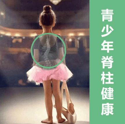 青少年脊柱畸形发病率逐年提高 专家呼呼扩大筛查面
