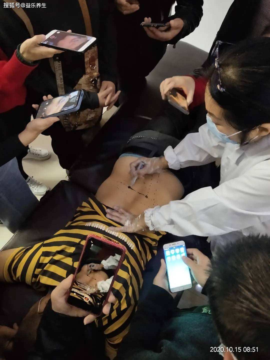 挑羊毛疔为何流传在民间挑出的到底是不是羊毛