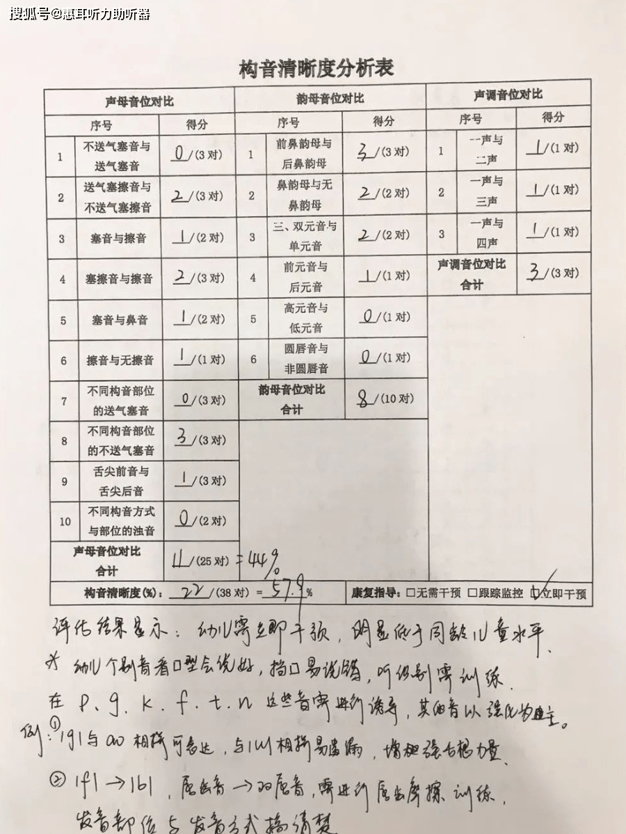 左耳为Ⅲ度小耳畸形,右耳为Ⅱ度小耳畸形 02 听力检查和构音评估