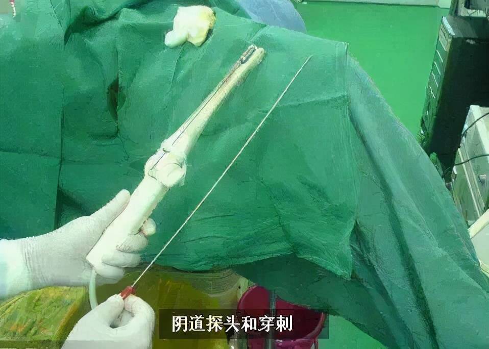 "5万一次,刺穿取卵":被放纵欲望毁掉的年轻女孩们_手机搜狐网