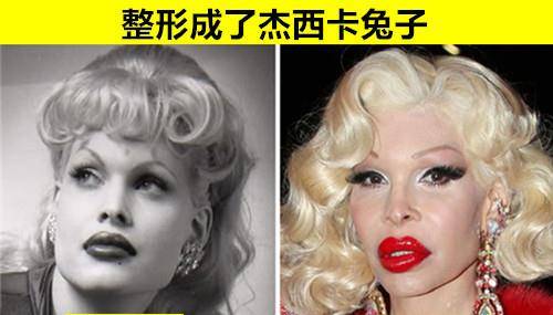 美丽的代价:由于过度整容,而让自己变成"丑八怪"的7个人