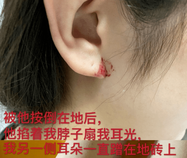 张培萌事件反转发长文控诉遭妻子持刀威胁还多次被妻子家暴