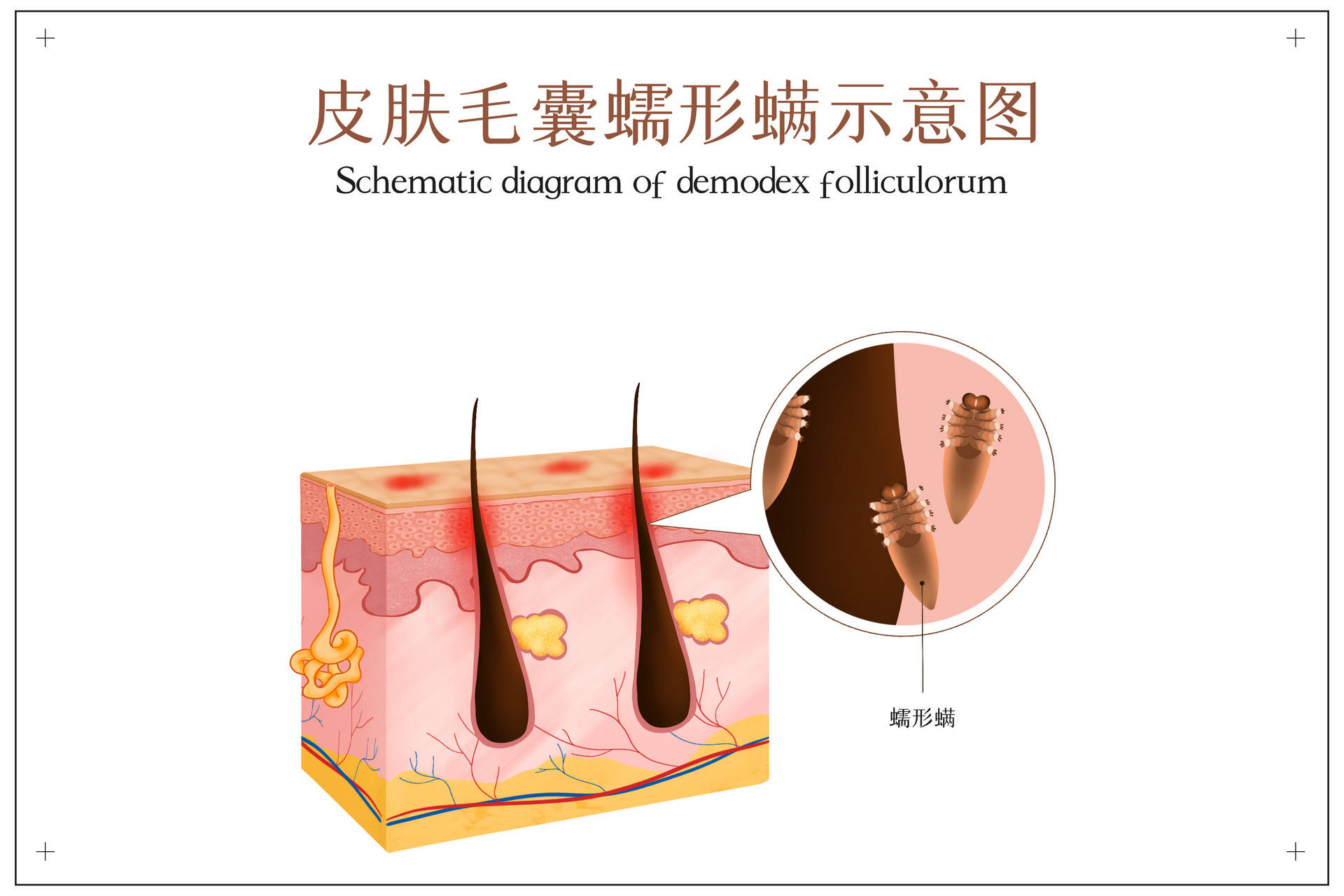 不过,对于臀部上面长痘的情况,似乎让很多人无法理解,所以当
