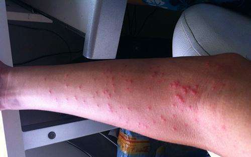 每100秒就有一名孩子感染艾滋病 为何如此泛滥?