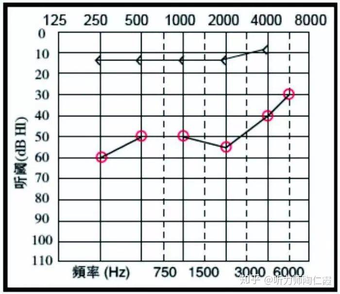 如何看懂听力图