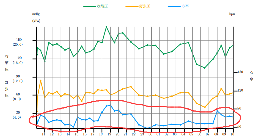 孕妇24小时动态血压图片