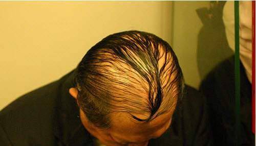原创奇闻日本大叔已秃顶的发型设计变特殊为独特网友不忍直视