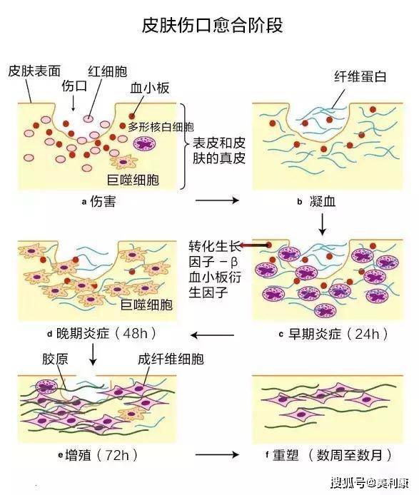 小伤口也会造成大伤害!从伤口愈合原理学习如何正确处理伤口