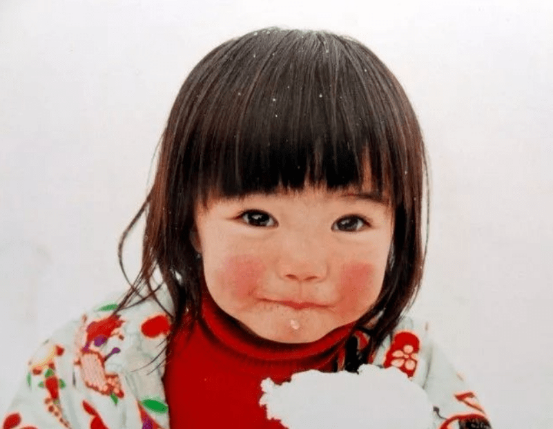 一到冬天孩子脸上就出现"高原红",本以为是过敏,原来想错了