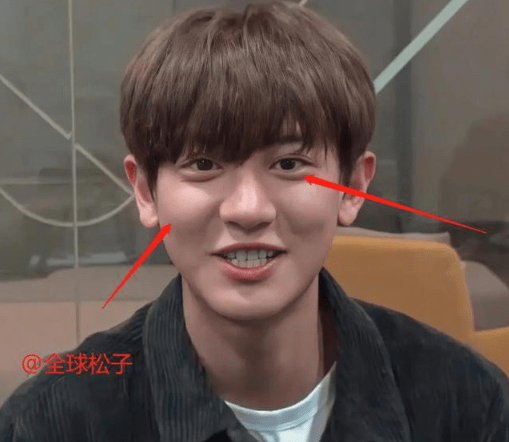 原创吴世勋近况曝光脸颊发腮眼睛变小让人认不出