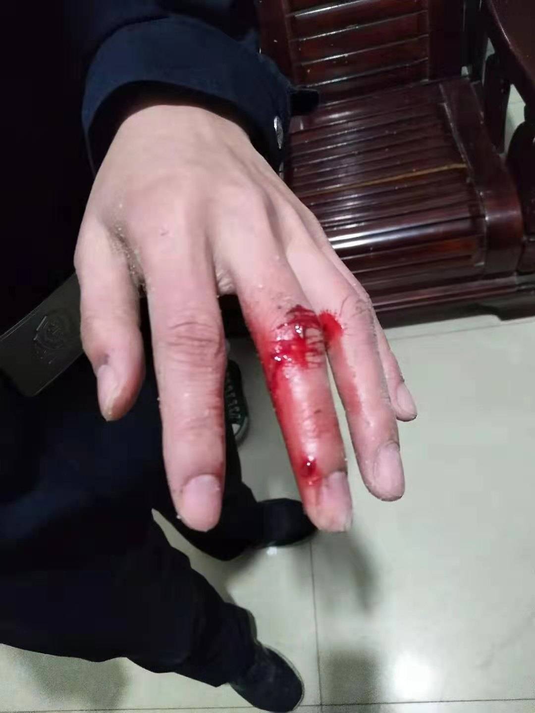 节日我在岗民警奋勇灭火负伤