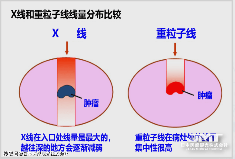 音乐治耳鸣是什么原理_耳鸣是什么原因引起的(2)