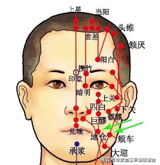 ⑿巨髎:出自《針灸甲乙經》,屬足陽明胃經,手足陽明,陽蹻之會.