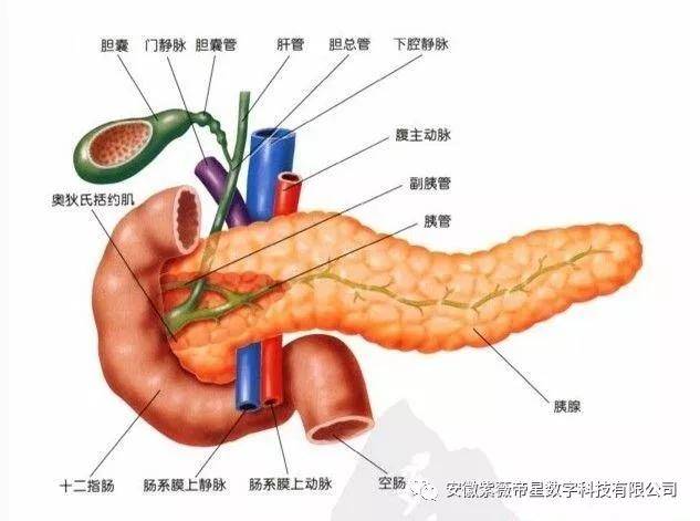 胰头癌示意图图片