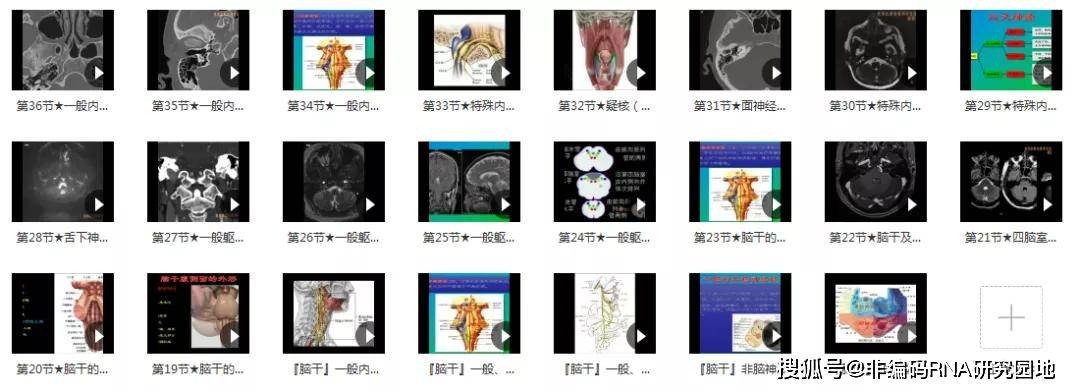 一般內臟運動核(動眼神經副核解剖及影像表現)/ 一般內臟運動核(上泌