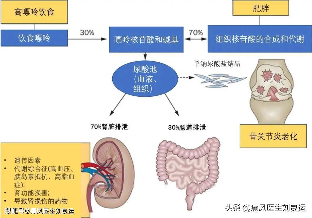 痛风患者降尿酸选哪种药七种方法分辨尿酸生成过多还是排泄减少