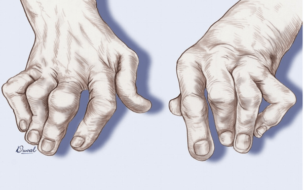 98d8d1bed1934f4286e993f589607d21.png