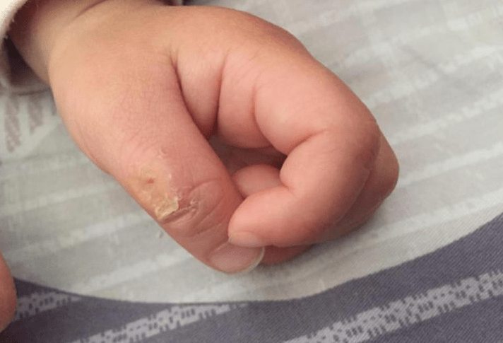 小婴儿专心掰手指,表情有些淡淡的忧伤,是在算挨训几次吗?