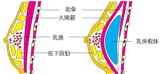 210fc33b79a54782b788232fbfd20e86.png