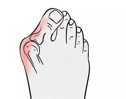 高跟鞋怎么画的简单又漂亮 d13e8715cc53452896325edf97717bb8.png