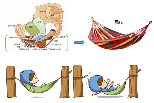 这个"支撑"主要由盆底肌肉群,筋膜,韧带等结构组成.