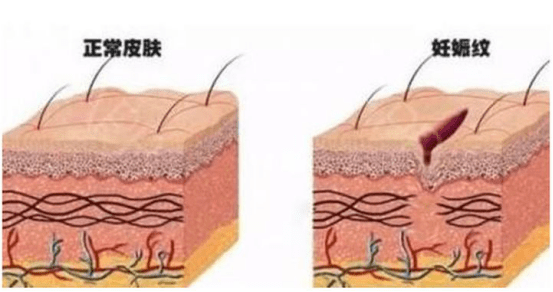 娇韵诗的妊娠油怎么看效期