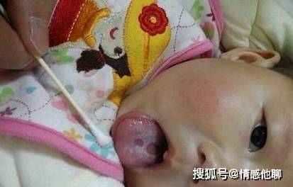 怎么样看舌苔是脾胃不好 e2449a20433e41eb895b9cb727500330.jpeg