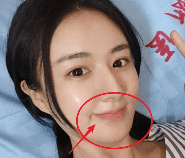 原创素颜状态引关注35岁薇娅做手术晒自拍都羡慕纯天然的脸