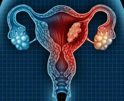男人怎么避免hpv 897b2e1d044949b7ba1958e59a0bdbc8.png