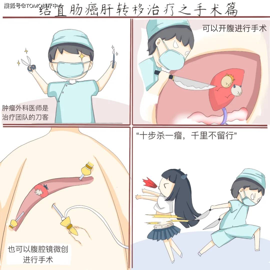 腹腔镜手术漫画图片