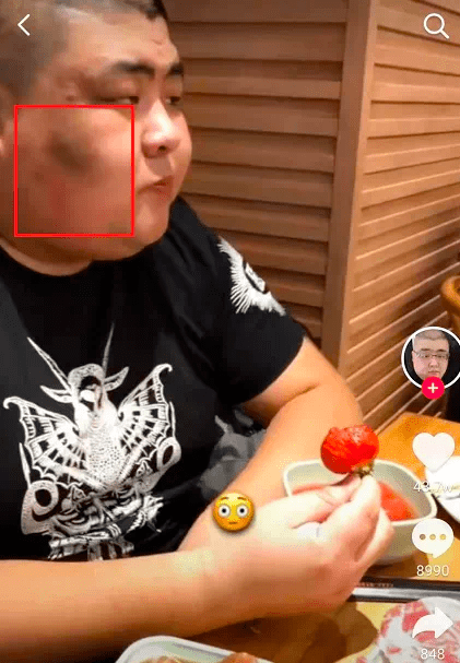 原创网红泡泡龙死因引争议网友称催吐伤身医生认为其暴饮暴食心源性