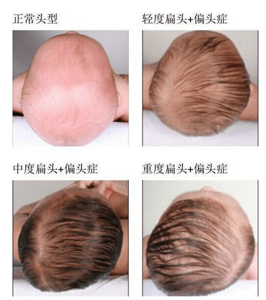 家长别被误导_宝宝