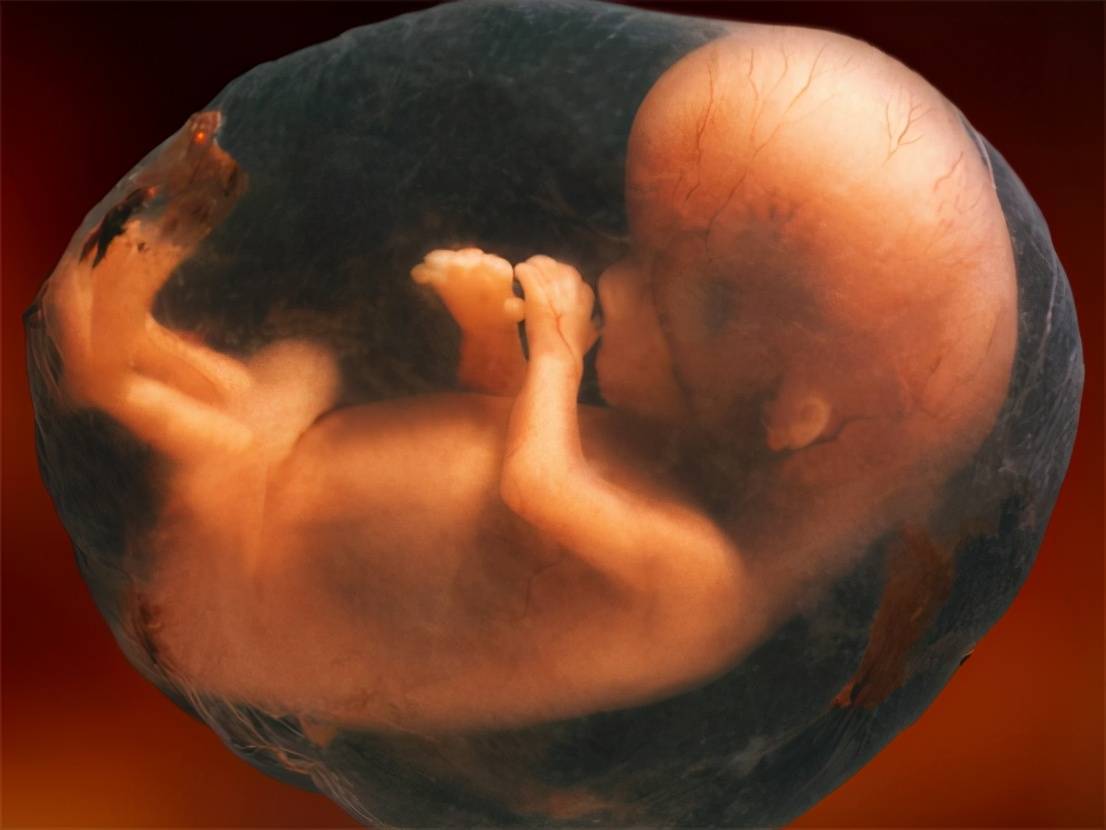 第二次:孕28~30周,怀孕期间的大排畸工作,通过b超检查查看胎儿在发育