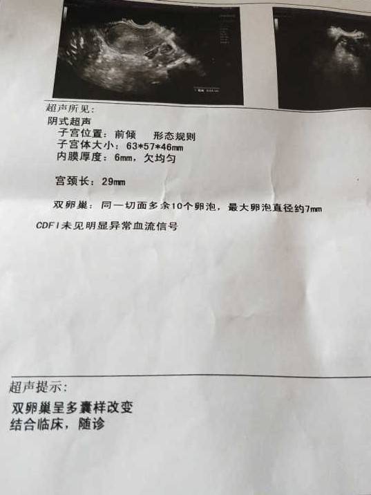 啥叫自然怀孕 18ef9615d9fd4adebabbf9516a837bc7.jpeg