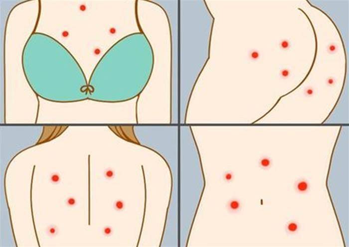 原创身上长出不痛不痒的小红点是肝病吗提醒警惕这4种疾病