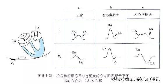 心電圖零基礎入門乾貨滿滿