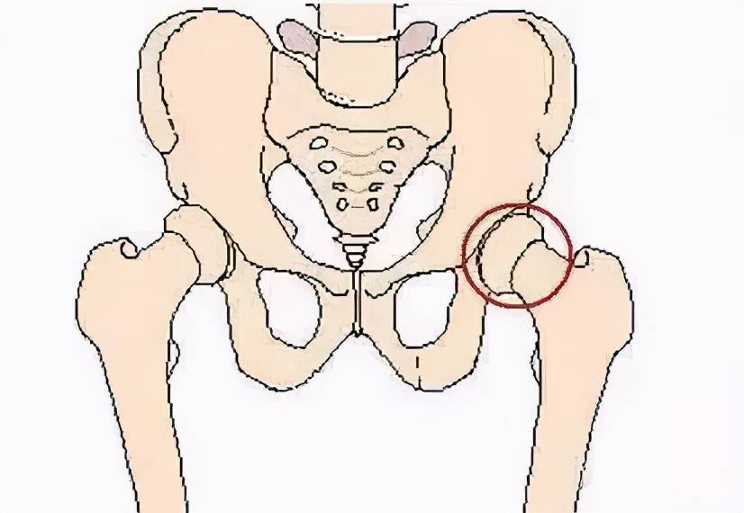 年纪轻轻腰椎间盘突出这样做缓解腰椎间盘疼痛